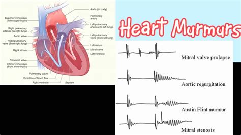 arrhythmia heart murmur